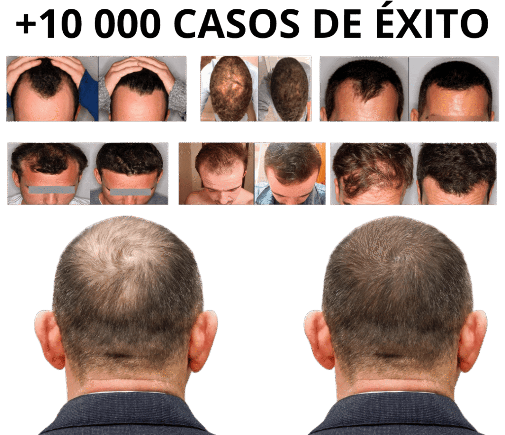 Resultados clientes