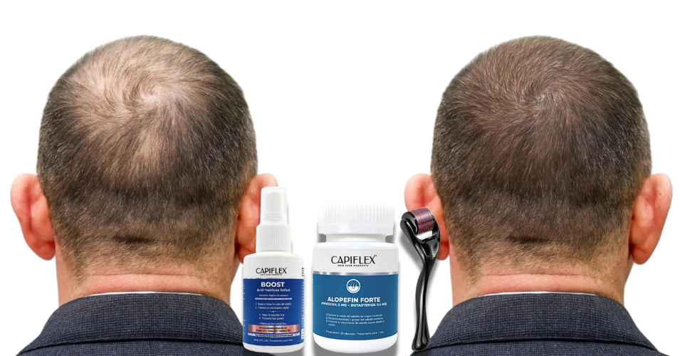 Clientes Exito Alopecia