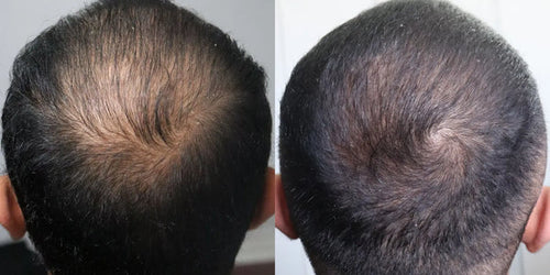 Antes y después