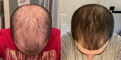Antes y después