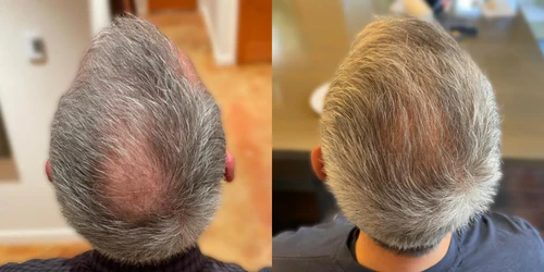 Antes y después