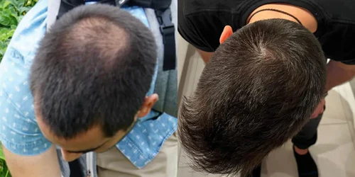 Antes y después