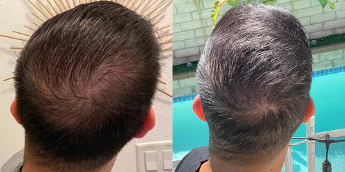 Antes y después