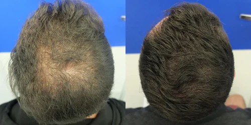 Antes y después
