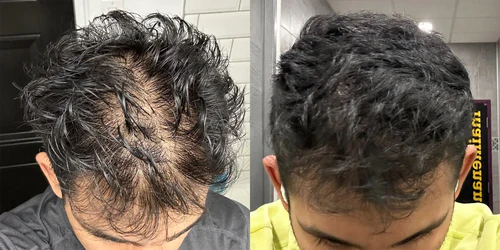 Antes y después